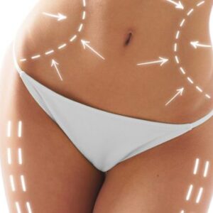 Karın ve Bel Bölgesinin Şekillendirilmesi (Karın germe ve liposuction)